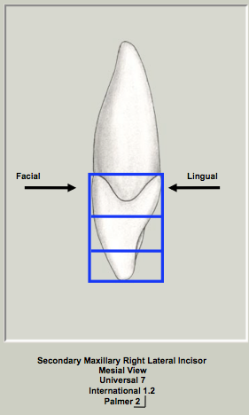 Prox Mx Lateral CofC.png